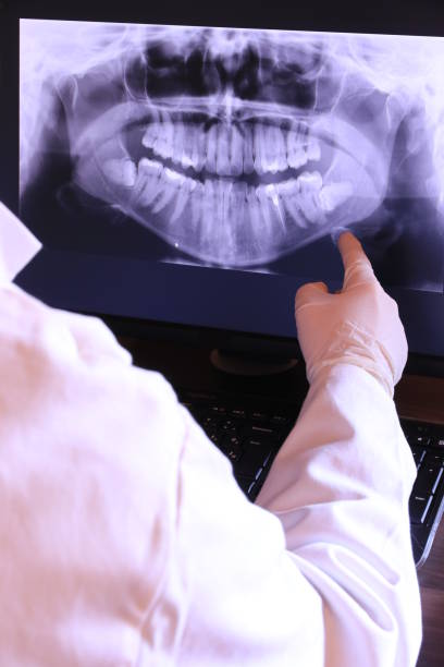 Best Emergency Dental Services for Seniors in Santa Claus, IN